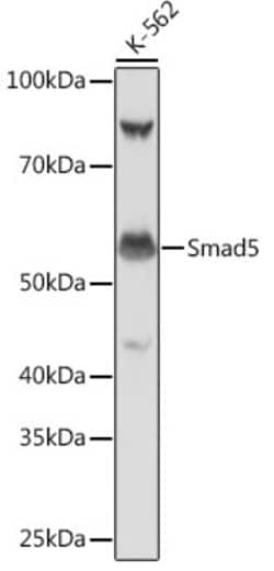 Invitrogen SMAD5 Recombinant Rabbit Monoclonal Antibody (1X5G9) 100 &mu;L;