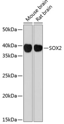 Invitrogen SOX2 Recombinant Rabbit Monoclonal Antibody (10L6W5) 100 &mu;L | Buy Online | Invitrogen&trade; | Fisher Scientific