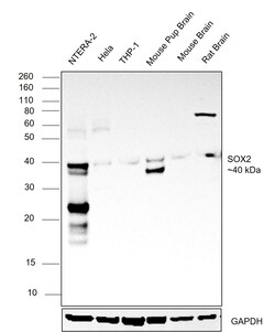 Invitrogen SOX2 Recombinant Rabbit Monoclonal Antibody (10L6W5) 100 &mu;L | Buy Online | Invitrogen&trade; | Fisher Scientific