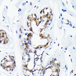 Invitrogen SUMO1 Recombinant Rabbit Monoclonal Antibody (6F8B6) 100 &mu;L | Buy Online | Invitrogen&trade; | Fisher Scientific