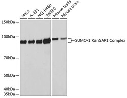 Invitrogen SUMO1 Recombinant Rabbit Monoclonal Antibody (6F8B6) 100 &mu;L | Buy Online | Invitrogen&trade; | Fisher Scientific