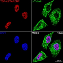 Invitrogen TDP-43 Recombinant Rabbit Monoclonal Antibody (4R5L7) 100 &mu;L;