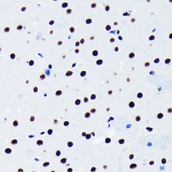 Invitrogen TDP-43 Recombinant Rabbit Monoclonal Antibody (4R5L7) 100 &mu;L;
