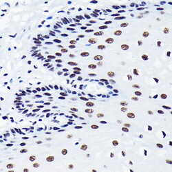Invitrogen TDP-43 Recombinant Rabbit Monoclonal Antibody (4R5L7) 100 &mu;L;
