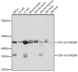 Invitrogen TDP-43 Recombinant Rabbit Monoclonal Antibody (4R5L7) 100 &mu;L;