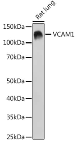 Invitrogen VCAM-1 (CD106) Recombinant Rabbit Monoclonal Antibody (7I1J9)