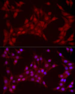 Invitrogen YAP1 Recombinant Rabbit Monoclonal Antibody (10G4S10) 100 &mu;L;