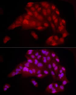 Invitrogen YAP1 Recombinant Rabbit Monoclonal Antibody (10G4S10) 100 &mu;L;