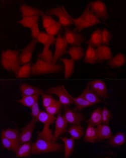 Invitrogen YAP1 Recombinant Rabbit Monoclonal Antibody (10G4S10) 100 &mu;L;