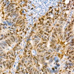 Invitrogen YAP1 Recombinant Rabbit Monoclonal Antibody (10G4S10) 100 &mu;L;
