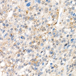 Invitrogen YAP1 Recombinant Rabbit Monoclonal Antibody (10G4S10) 100 &mu;L;