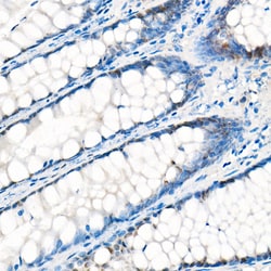 Invitrogen YAP1 Recombinant Rabbit Monoclonal Antibody (10G4S10) 100 &mu;L;