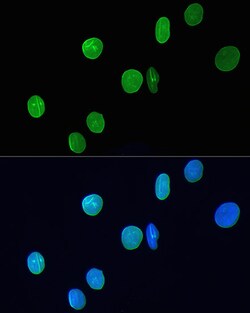 Invitrogen Lamin A/C Recombinant Rabbit Monoclonal Antibody (4L8Q0) 100