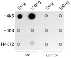 Invitrogen H4K5ac Recombinant Rabbit Monoclonal Antibody (10G1L0) 100 &mu;L | Buy Online | Invitrogen&trade; | Fisher Scientific