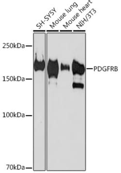 Invitrogen PDGFRB Recombinant Rabbit Monoclonal Antibody (6E8C10) 100 &mu;L | Buy Online | Invitrogen&trade; | Fisher Scientific