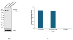 Invitrogen PDGFRB Recombinant Rabbit Monoclonal Antibody (6E8C10) 100 &mu;L | Buy Online | Invitrogen&trade; | Fisher Scientific