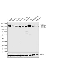 Invitrogen PDGFRB Recombinant Rabbit Monoclonal Antibody (6E8C10) 100 &mu;L | Buy Online | Invitrogen&trade; | Fisher Scientific