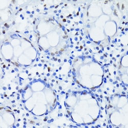 Invitrogen HIF-1 beta Recombinant Rabbit Monoclonal Antibody (3R0Y4) 100