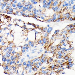 Invitrogen AIF Recombinant Rabbit Monoclonal Antibody (5F0Y1) 100 &mu;L;