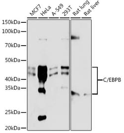 Invitrogen C/EBP beta Recombinant Rabbit Monoclonal Antibody (9W4A10) 100
