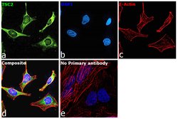 Invitrogen TSC2 Recombinant Rabbit Monoclonal Antibody (7X2C6) 100 &mu;L;