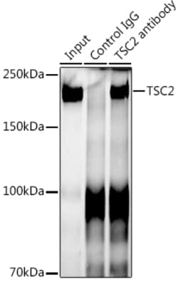 Invitrogen TSC2 Recombinant Rabbit Monoclonal Antibody (7X2C6) 100 &mu;L;