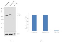 Invitrogen TSC2 Recombinant Rabbit Monoclonal Antibody (7X2C6) 100 &mu;L;