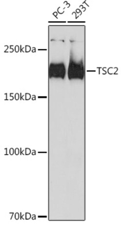 Invitrogen TSC2 Recombinant Rabbit Monoclonal Antibody (7X2C6) 100 &mu;L;
