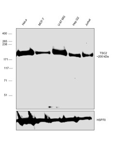 Invitrogen TSC2 Recombinant Rabbit Monoclonal Antibody (7X2C6) 100 &mu;L;