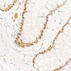 Invitrogen CHK2 Recombinant Rabbit Monoclonal Antibody (2W5N3) 100 &mu;L;