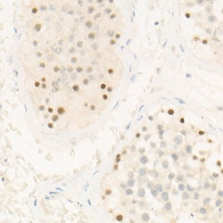 Invitrogen CHK2 Recombinant Rabbit Monoclonal Antibody (2W5N3) 100 &mu;L;