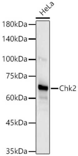 Invitrogen CHK2 Recombinant Rabbit Monoclonal Antibody (2W5N3) 100 &mu;L;