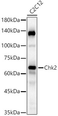 Invitrogen CHK2 Recombinant Rabbit Monoclonal Antibody (2W5N3) 100 &mu;L;