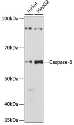 Invitrogen Caspase 8 Recombinant Rabbit Monoclonal Antibody (7R6N8) 100 &mu;L | Buy Online | Invitrogen&trade; | Fisher Scientific