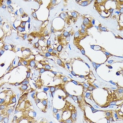 Invitrogen RARA Recombinant Rabbit Monoclonal Antibody (9C7R10) 100 &mu;L;