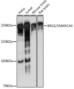 Invitrogen BRG1 Recombinant Rabbit Monoclonal Antibody (4N9C4) 100 &mu;L;