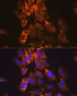 Invitrogen MEK1 Recombinant Rabbit Monoclonal Antibody (3U10A1) 100 &mu;L;