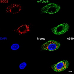 Invitrogen SOD2 Recombinant Rabbit Monoclonal Antibody (9T2Z1) 100 &mu;L;