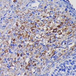 Invitrogen SOD2 Recombinant Rabbit Monoclonal Antibody (9T2Z1) 100 &mu;L;
