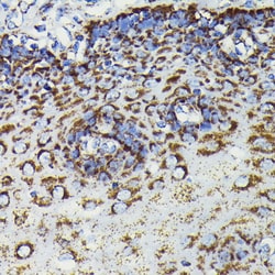Invitrogen SOD2 Recombinant Rabbit Monoclonal Antibody (9T2Z1) 100 &mu;L;