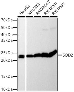 Invitrogen SOD2 Recombinant Rabbit Monoclonal Antibody (9T2Z1) 100 &mu;L;