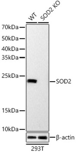 Invitrogen SOD2 Recombinant Rabbit Monoclonal Antibody (9T2Z1) 100 &mu;L;