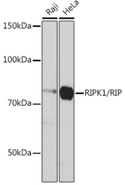 Invitrogen RIP1 Recombinant Rabbit Monoclonal Antibody (2V4N8) 100 &mu;L | Buy Online | Invitrogen&trade; | Fisher Scientific