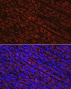 Invitrogen NQO1 Recombinant Rabbit Monoclonal Antibody (9M3H10) 100 &mu;L;