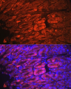Invitrogen NQO1 Recombinant Rabbit Monoclonal Antibody (9M3H10) 100 &mu;L;