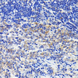 Invitrogen ATG7 Recombinant Rabbit Monoclonal Antibody (3X1W4) 100 &mu;L;
