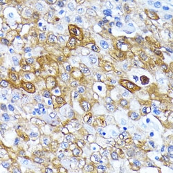 Invitrogen ATG7 Recombinant Rabbit Monoclonal Antibody (3X1W4) 100 &mu;L;