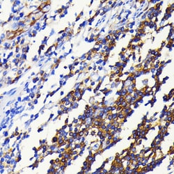 Invitrogen NFkB p52/p100 Recombinant Rabbit Monoclonal Antibody (4K3V3) 100 &mu;L | Buy Online | Invitrogen&trade; | Fisher Scientific