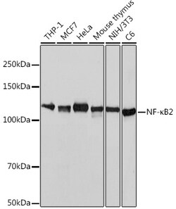 Invitrogen NFkB p52/p100 Recombinant Rabbit Monoclonal Antibody (4K3V3) 100 &mu;L | Buy Online | Invitrogen&trade; | Fisher Scientific