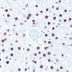 Invitrogen HuR Recombinant Rabbit Monoclonal Antibody (9Q6L3) 100 &mu;L;